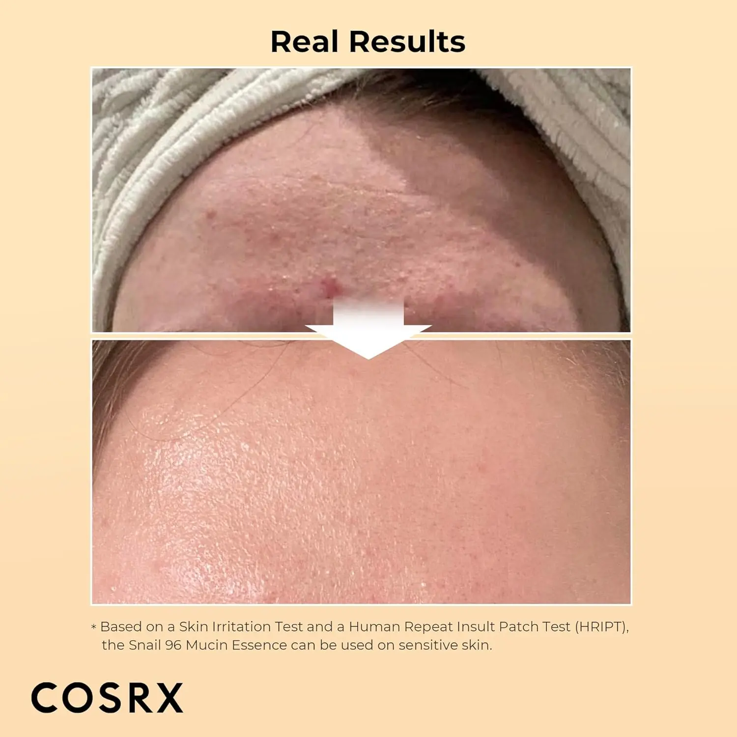  CORSX Snail serum