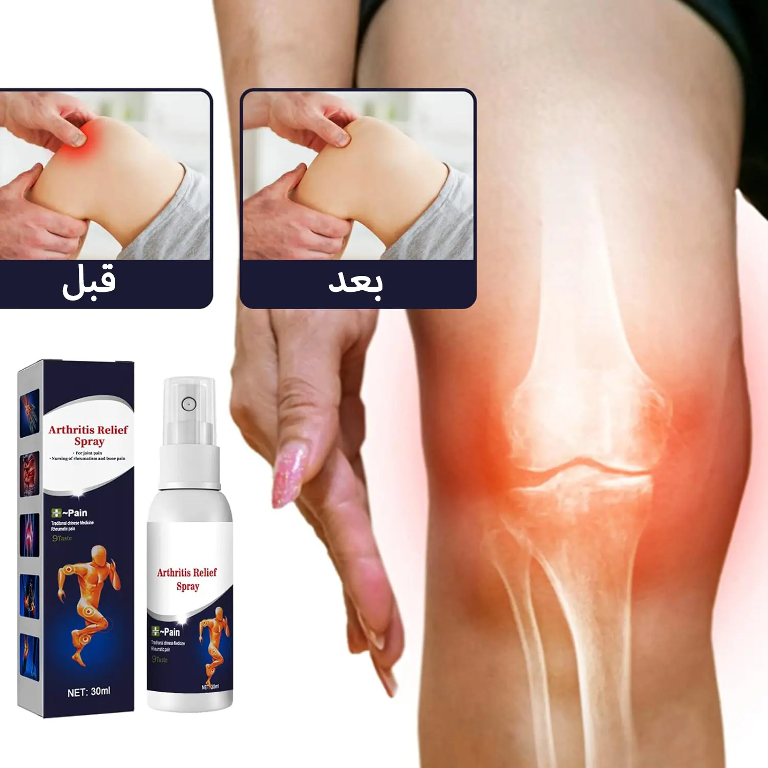  سبراي المفاصل السحري